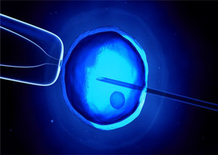 什么是體外受精