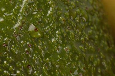 儿童龋齿的预防措施6