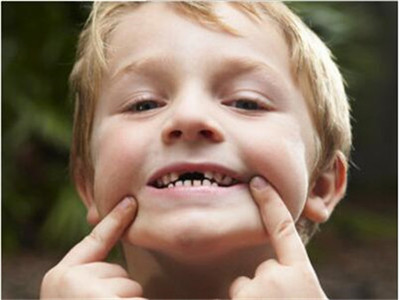儿童龋齿的治疗费用