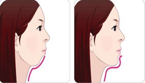 乳牙对颌面部骨骼发育的影响