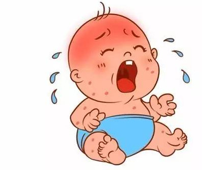 天气不热宝宝也出汗多，是正常还是疾病?