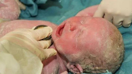 胎儿刚出生这东西一定不要清理干净，它是在保护宝宝的！