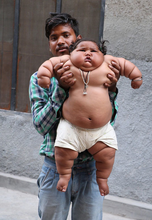 印度8个月巨婴 体重34斤成米其林小胖人
