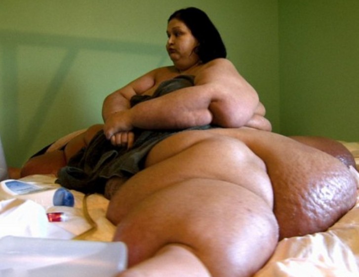 世界最胖女子成功减重700多斤成常人