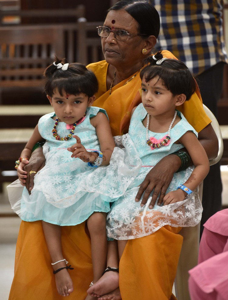 印度连体姐妹分离手术成功