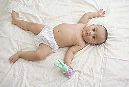 新生儿脐疝是个什么症状？快对照自家宝宝看看！