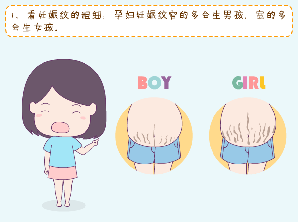 妊娠纹看生男生女准吗