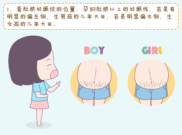 妊娠纹看生男生女准吗