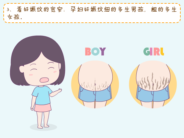 妊娠纹看生男生女准吗