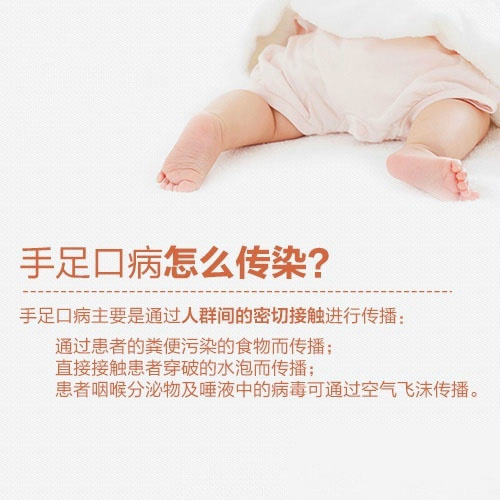 宝宝手足口病长啥样？如何分辨是否得病？