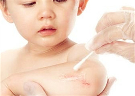 宝宝摔倒擦伤怎么处理 紫药水创可贴不能随便乱用