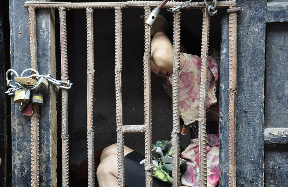 35岁女子患“怪病”被锁牢笼 无人敢靠近