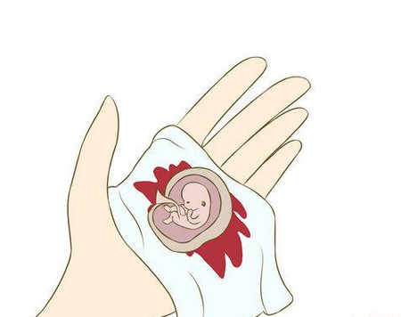 孕期阴道出血可能原因有哪些？