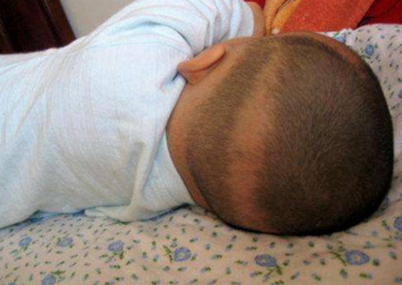 宝宝枕秃一定是缺钙吗？
