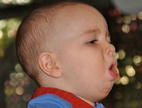 宝宝风热咳嗽食疗方法有哪些 小儿风热咳嗽偏方食谱大全