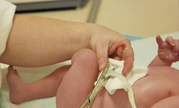 美国的妈妈们是怎么护理宝宝脐带的？