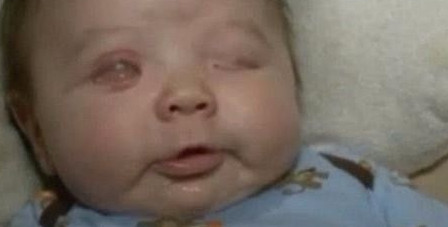 新生儿眼睛严重畸形！都是因为孕妈做错了这些！