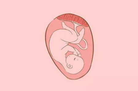 胎位和宝宝性别真的有关吗？