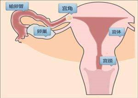 宫角妊娠如何手术 带你了解手术全过程