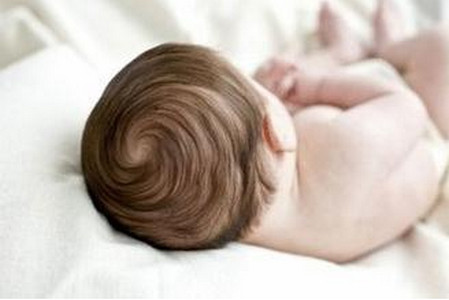 宝宝枕秃是由哪些因素导致的？