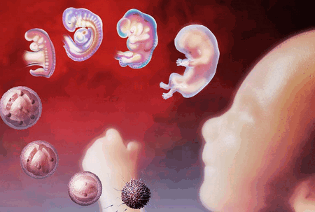 早孕是多胎，生出来只有一个，其他的胚胎去哪了？
