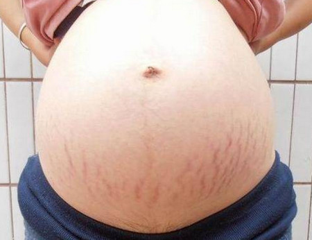 女性在25岁生孩子和在35岁生孩子之间的区别很大吗