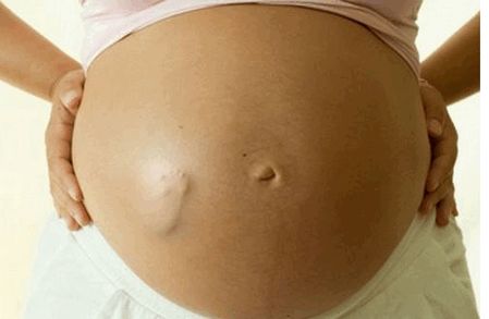 胎儿打嗝是什么感觉，算是胎动吗?