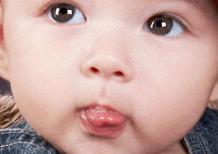 宝宝舌苔厚口腔有异味，怎么办？
