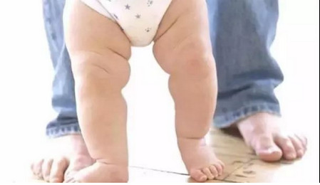 宝宝肋外翻、O型腿、X型腿就是缺钙吗？