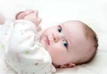 新生儿生理性黄疸有什么症状？新生儿黄疸该注意什么？