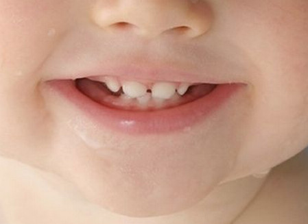 预防宝宝龋齿，从保护好宝宝的乳牙开始
