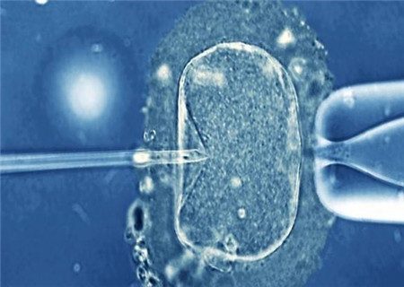 试管婴儿胚胎细胞级别 每级详细讲解