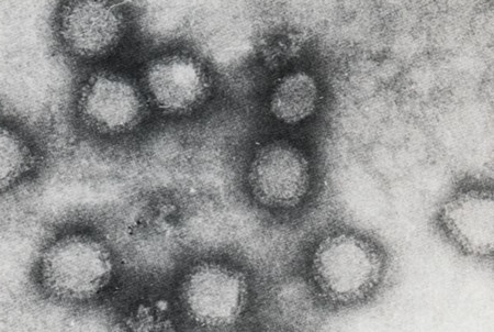 婴幼儿最易患的风疹，都有什么症状？