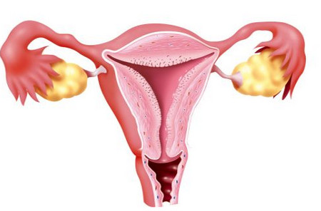 输卵管积水是炎症吗？会不会影响怀孕？