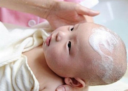 婴儿头上的胎脂能洗掉吗