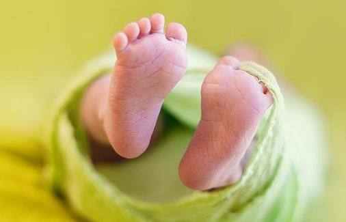 早产儿黄疸的特点 早产宝宝黄疸该怎么办