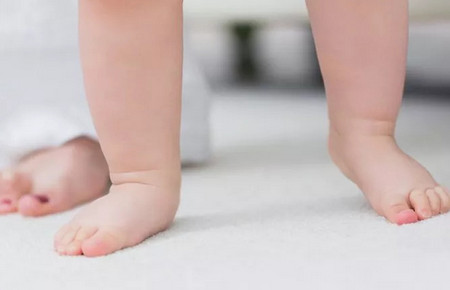 如何科学选宝宝鞋 罗圈腿、X型腿、内八字、外八字要紧吗？