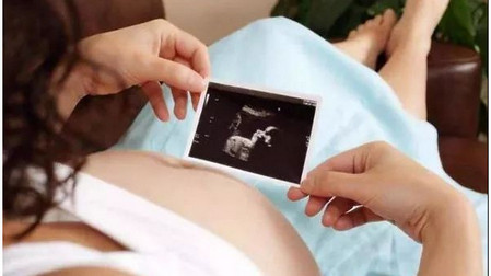 如何预防胎儿畸形 定期做B超检查