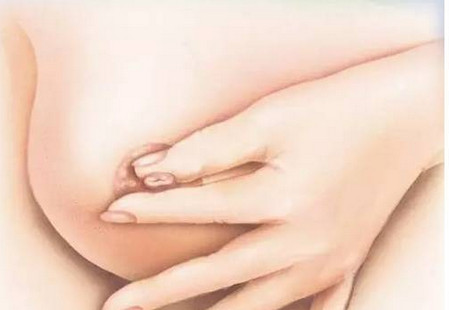 乳头瘙痒是乳腺癌吗 乳腺癌有哪些症状
