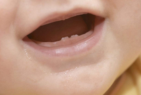宝宝乳牙护理知识有哪些