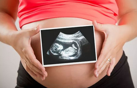 怀孕四个月有哪些检查项目