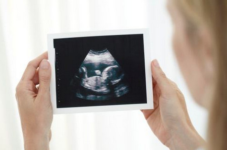 为什么大排畸放在孕中期？