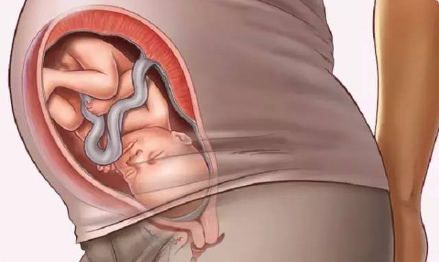 胎儿是怎样分娩出来的