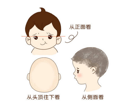  小儿积食会反复发烧吗