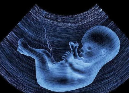 孕期怎样检测胎儿智力