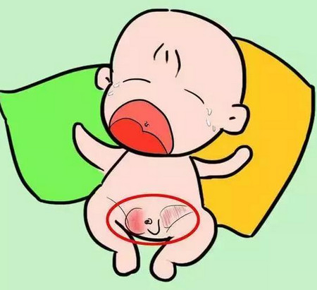 宝宝出现脐疝的原因及症状有哪些