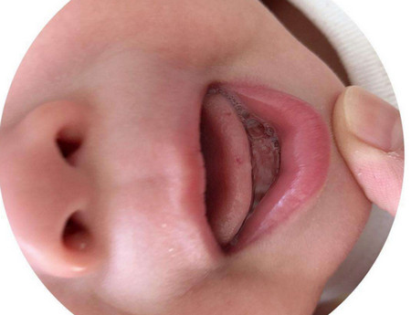 婴儿吐舌头怎么回事