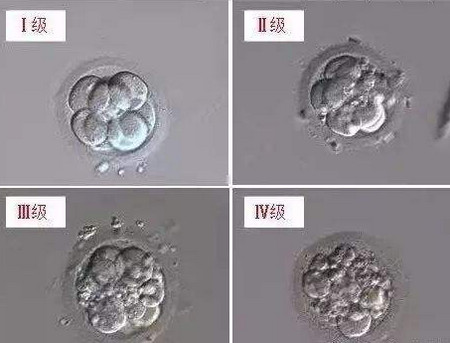 胚胎碎片是怎么回事