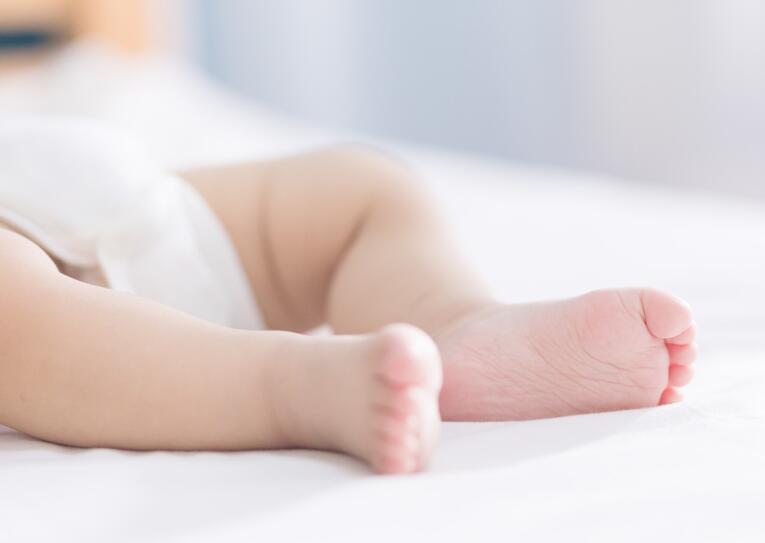 新生儿青色胎记的种类有哪些2