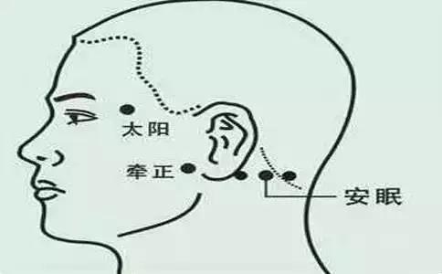 艾灸哪里可以治疗失眠1
